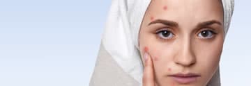 Fisioterapia Dermatofuncional: o tratamento da acne em adultos