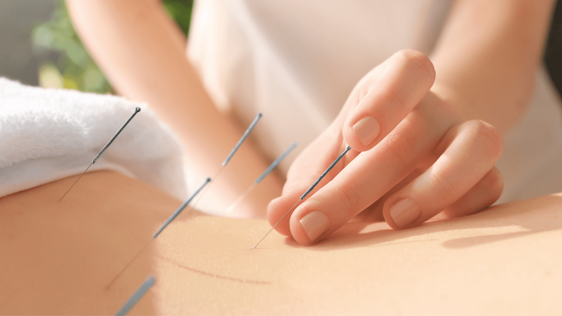 ACUPUNTURA