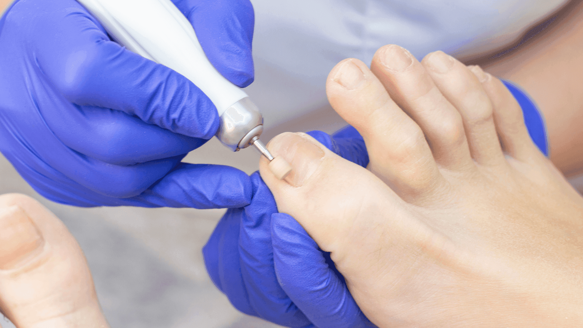 ENFERMAGEM EM PODIATRIA CLÍNICA